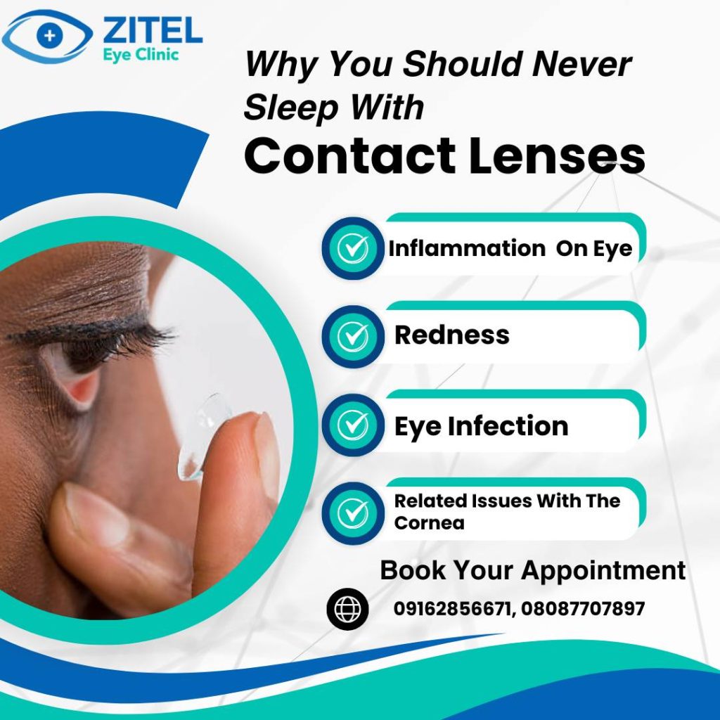 Contact Lens Fitting Abuja