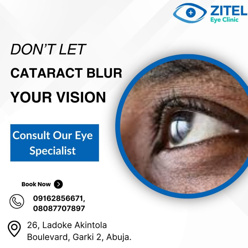 Affordable eye clinic Abuja